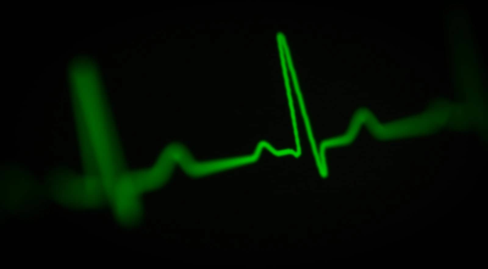EMS-Training mit Herzschrittmacher: Ist das erlaubt?