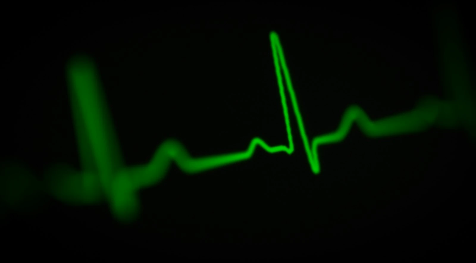 EMS-Training mit Herzschrittmacher: Ist das erlaubt?