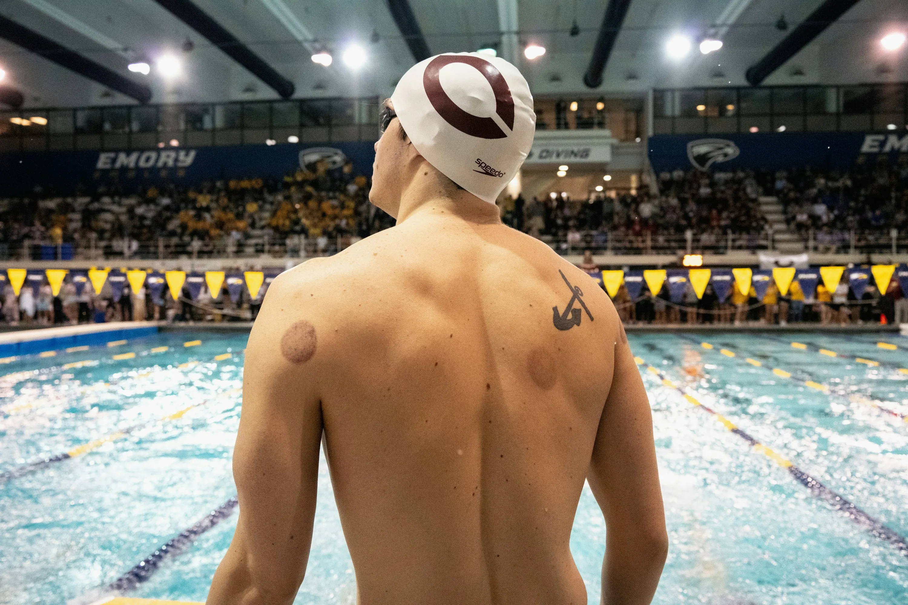 Schröpfen nach dem Sport: Hilft Cupping der Regeneration?